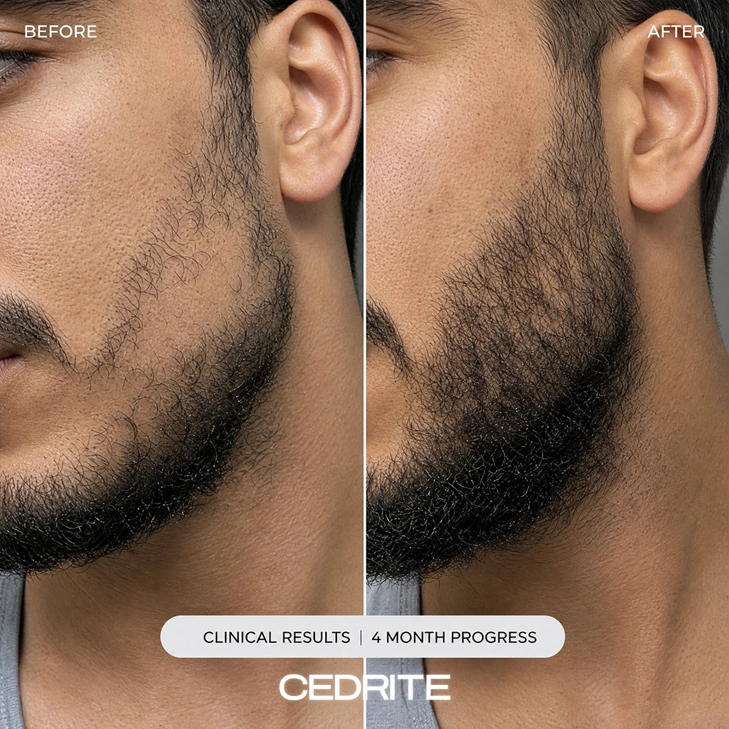 Test Cedrite for